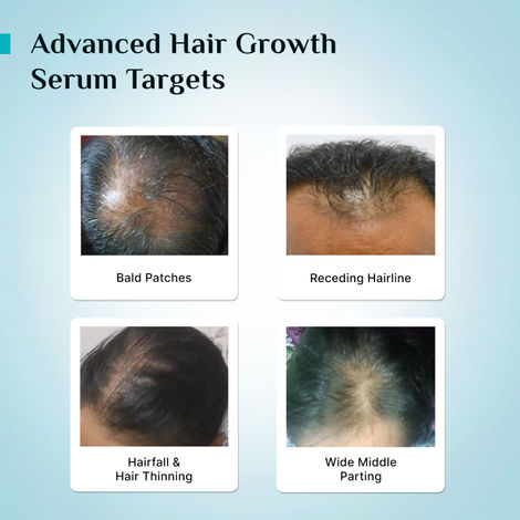 Pilgrim 3% Redensyl & 4% Anagain Advanced Hair Growth Serum