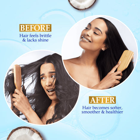 Parachute Advansed Gold Vitamin E Coconut Hair Oil| Long & Soft Hair| No Paraben & Silicones