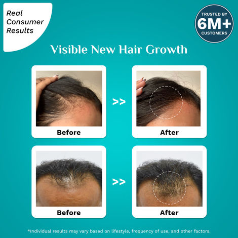 Pilgrim 3% Redensyl & 4% Anagain Advanced Hair Growth Serum