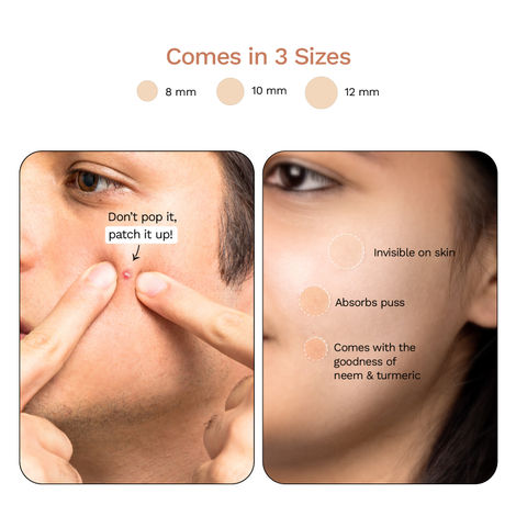 FURR By Pee Safe Acne Relief Patches Instant Spot Treatment for Acne & Pimples