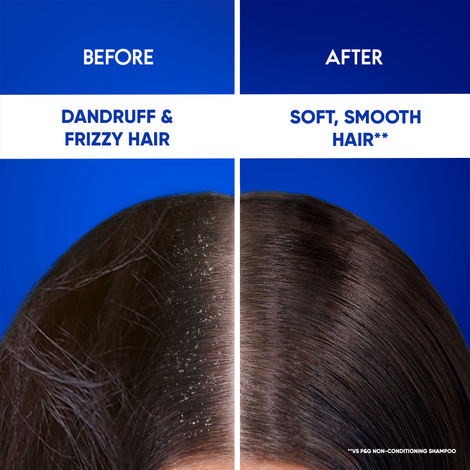 Head & Shoulders 2-In-1 Cool Menthol Anti Dandruff Shampoo + Conditioner For Women & Men