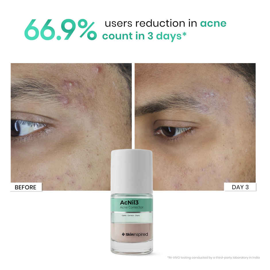 SkinInspired AcNil3 Acne Spot Corrector