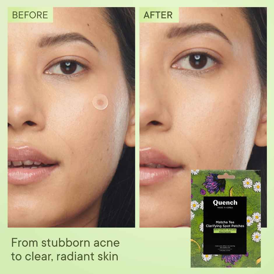 Quench Matcha Tea Clarifying Acne Patches
