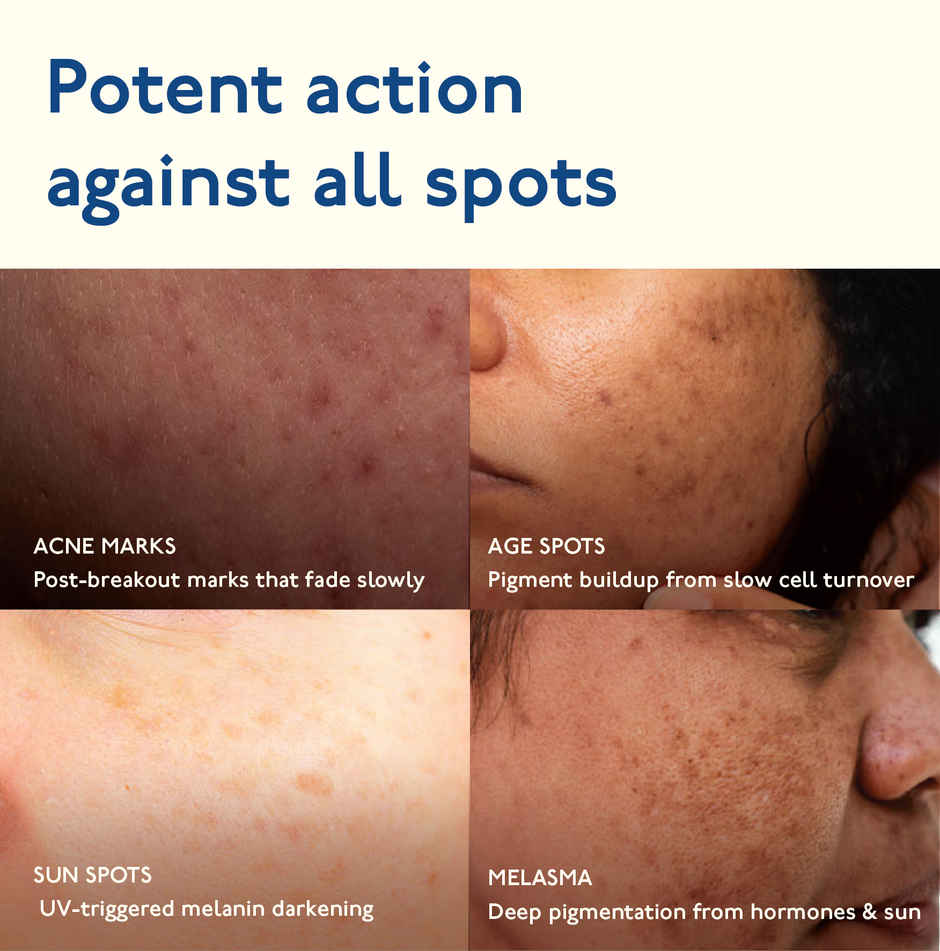 Asaya Advanced Dark Spot Targeting Gel