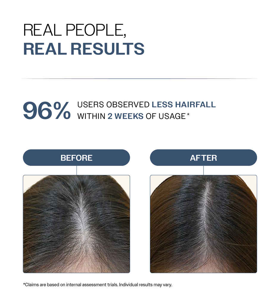 Bare Anatomy Anti Hair Fall Shampoo | 5x Hair Fall Control and Growth with Biotin, Adenosine