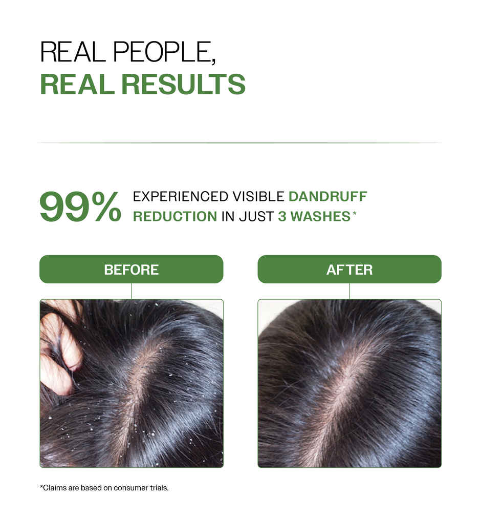 Bare Anatomy Anti-Dandruff Shampoo | Upto 100% Dandruff Reduction| Salicylic Acid, Biotin