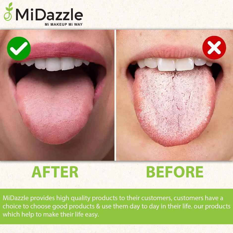 Midazzle Stainless Steel Tongue Cleaner with Brass Handle |MIOT7503