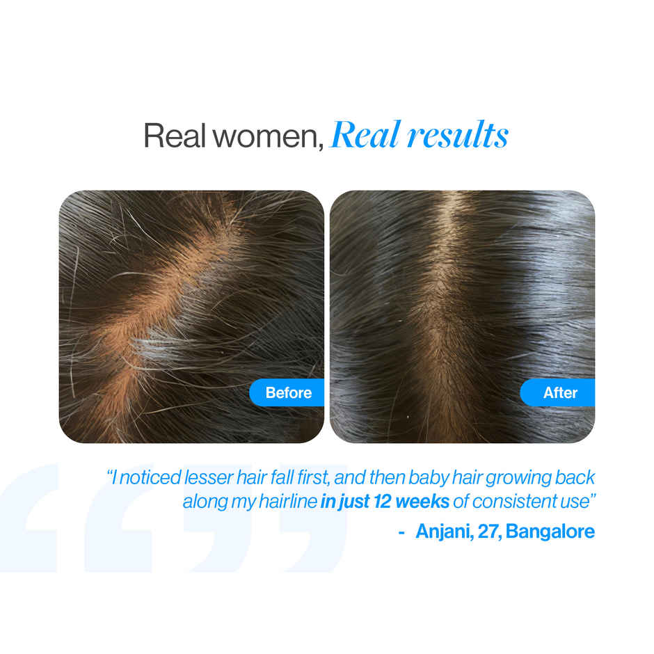 Be Bodywise Hair Growth Serum Roll on - Promotes Hair Growth & Stimulates Hair Follicles