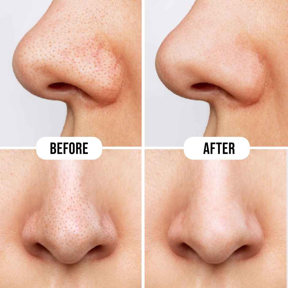 Hilary Rhoda Deep Cleanse Nose Strips | Removes Blackheads & Whiteheads | Charcoal - Shade 01