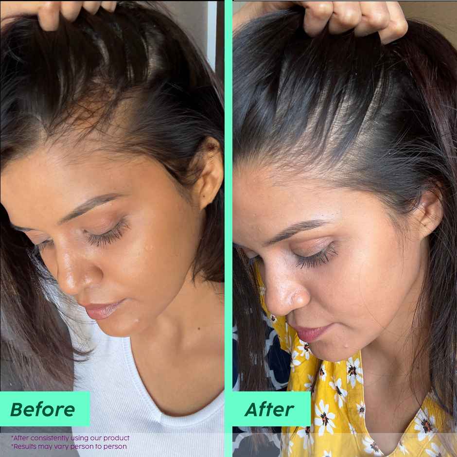 PLIX Rosemary Advanced Anti-Hair Fall Shampoo Sulfate And Paraben Free To Reduce Hair Fall