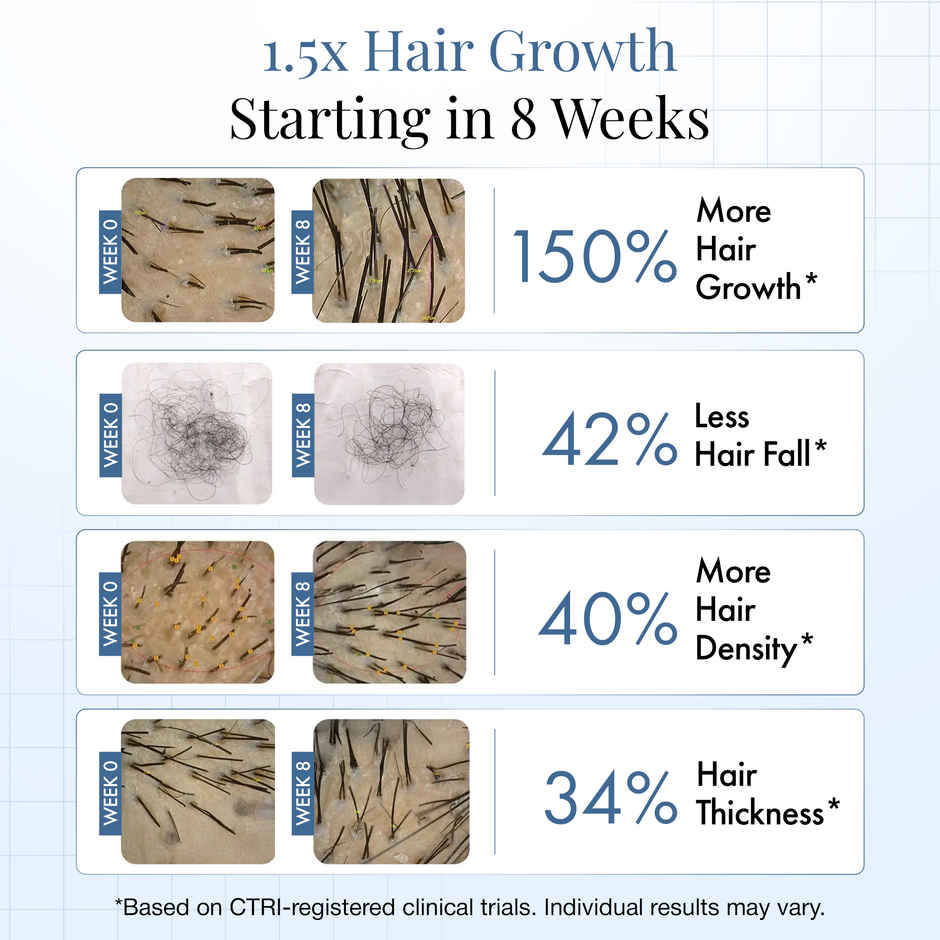 Thriveco Hair Growth Serum 2.0 For Hair Growth & Hair Fall Control