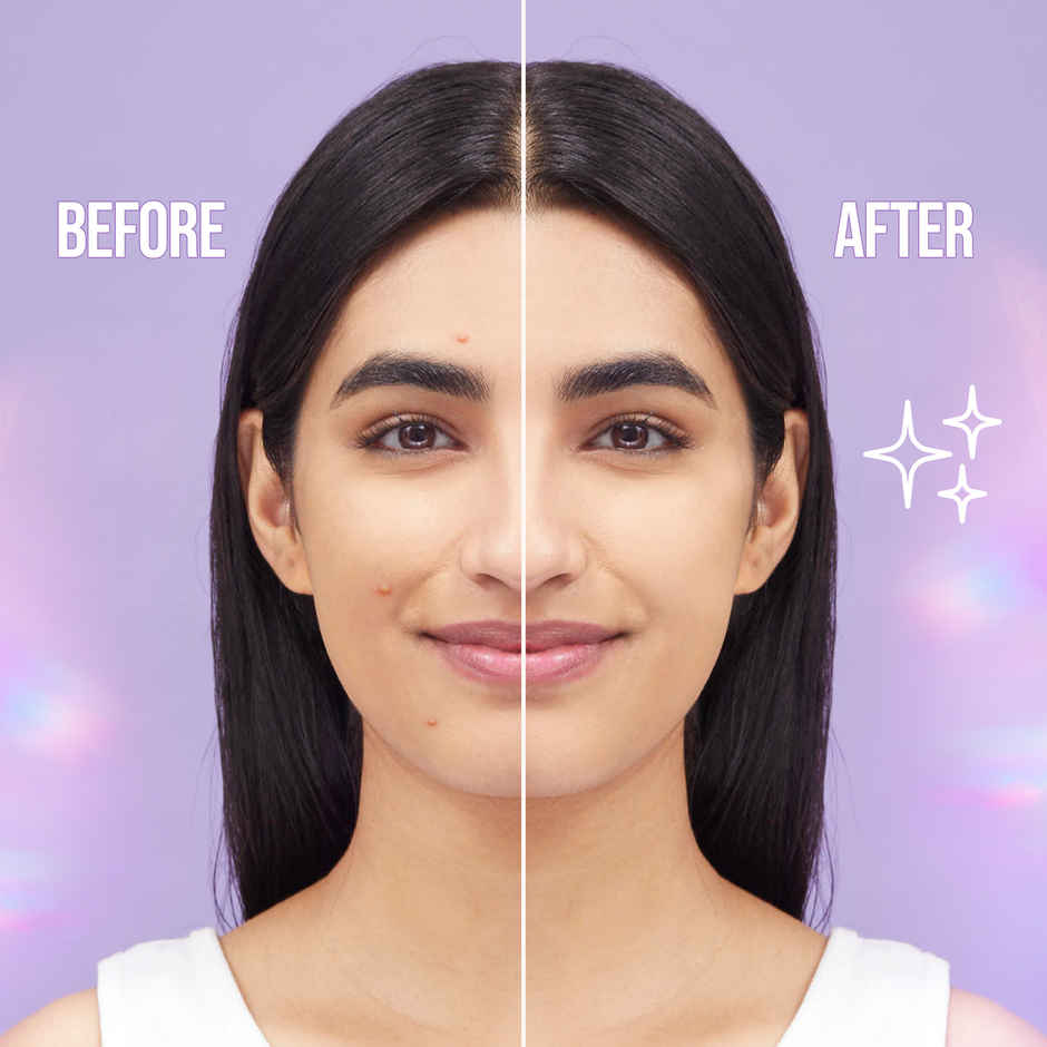Hilary Rhoda Clear Skin Pimple Patch | Absorbs Pimple Overnight & Reduces Excess Oil