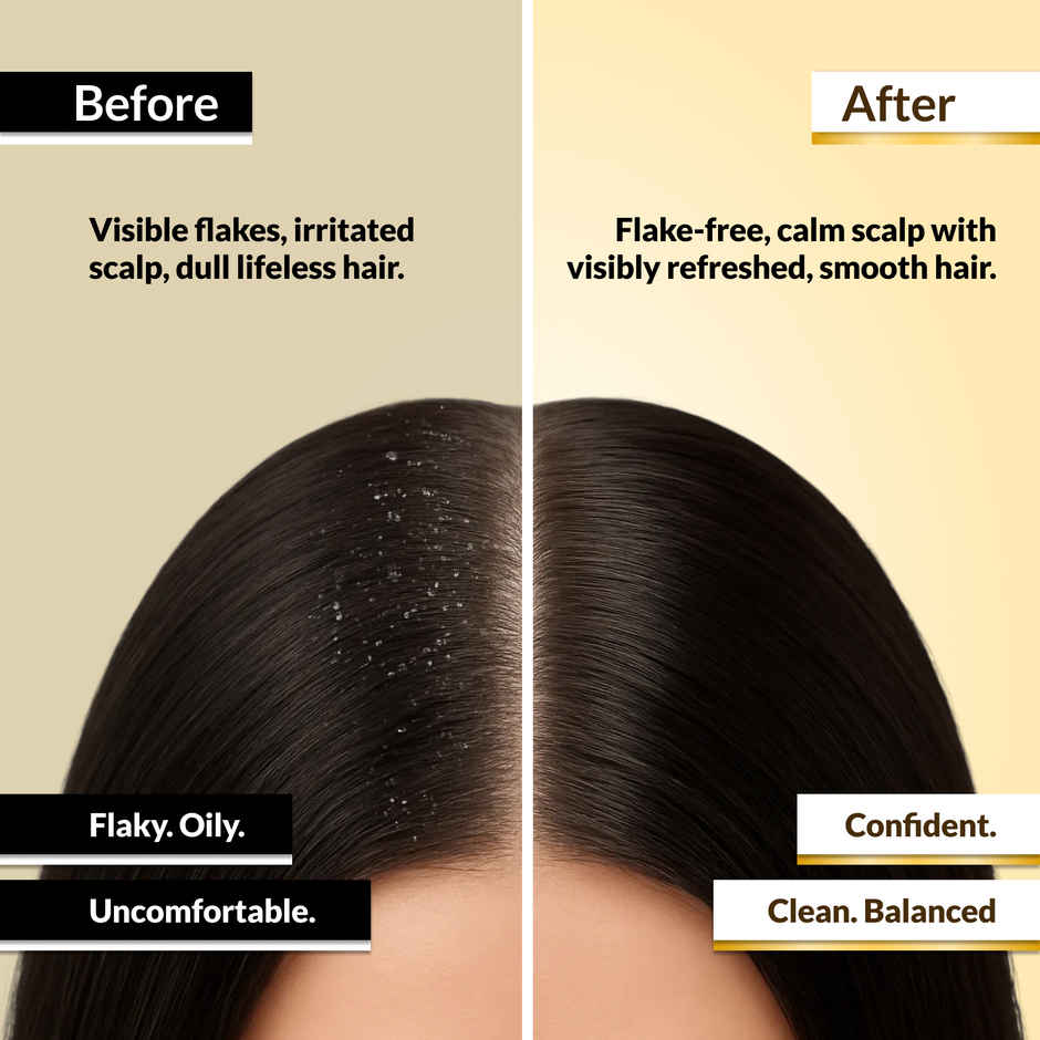 EleGanz Professional ScalpMatrix Anti-Dandruff Shampoo | Salicylic Acid + Dandrilys