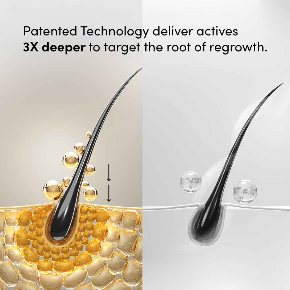 Man Matters Minoxifin Advance Hair Topical Solution