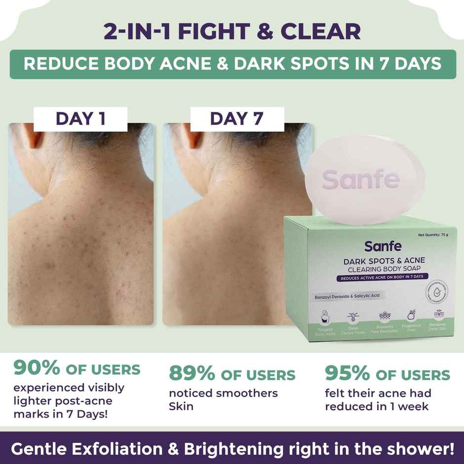 Sanfe Dark Spots & Acne Clearing Soap For Face And Body Pimple Removal Combo    