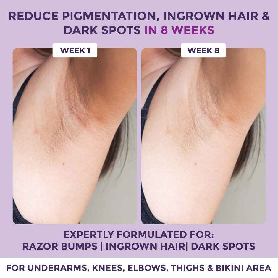 Sanfe Spotlite Ingrown Hair & Bumps Clearing Body Scrub Dark Underarms Inner Thigh &Sensitive Areas