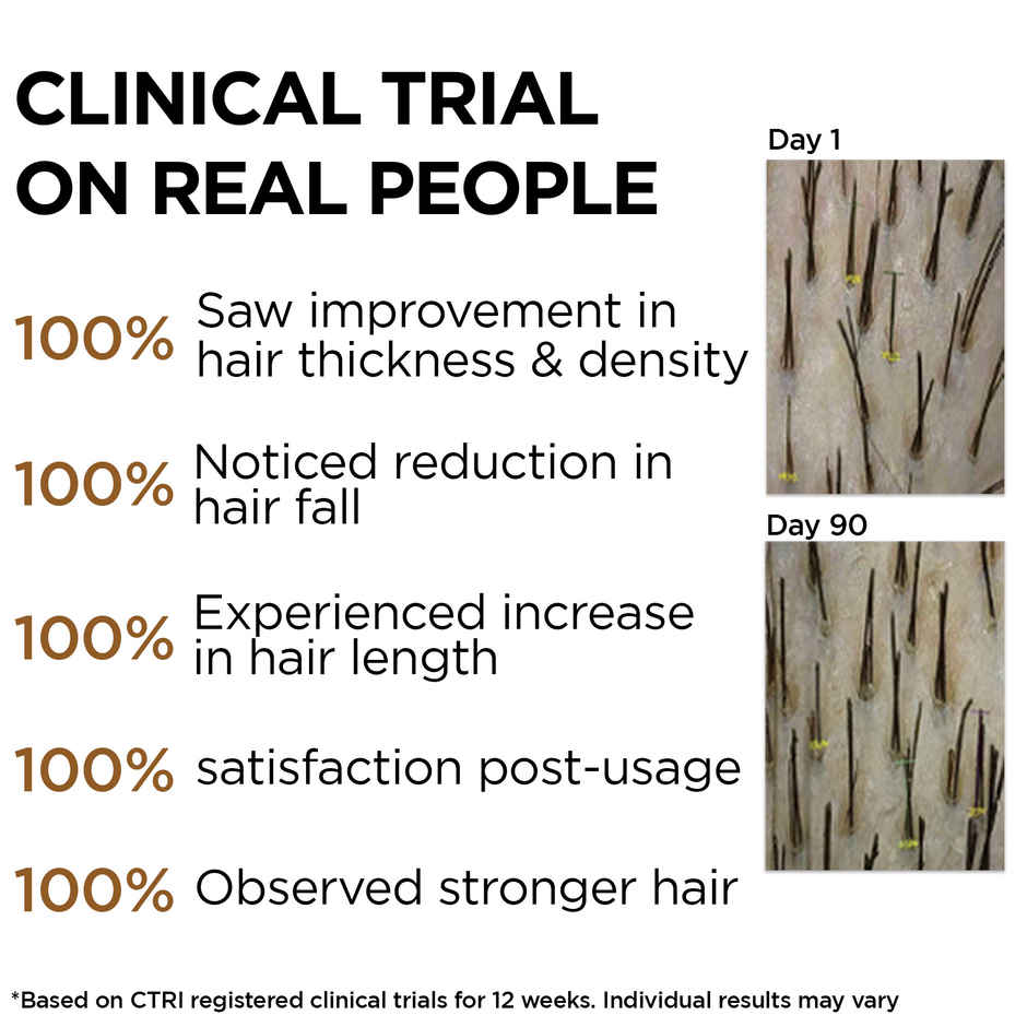 Soulflower Cold Pressed Coconut Hair Oil for Deep Nourishment