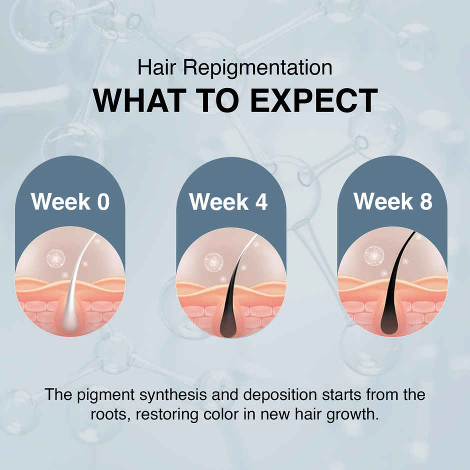 Thriveco Anti-Grey Hair Prime Serum Reverses & Limits Hair Greying Arcolys For Men And Women