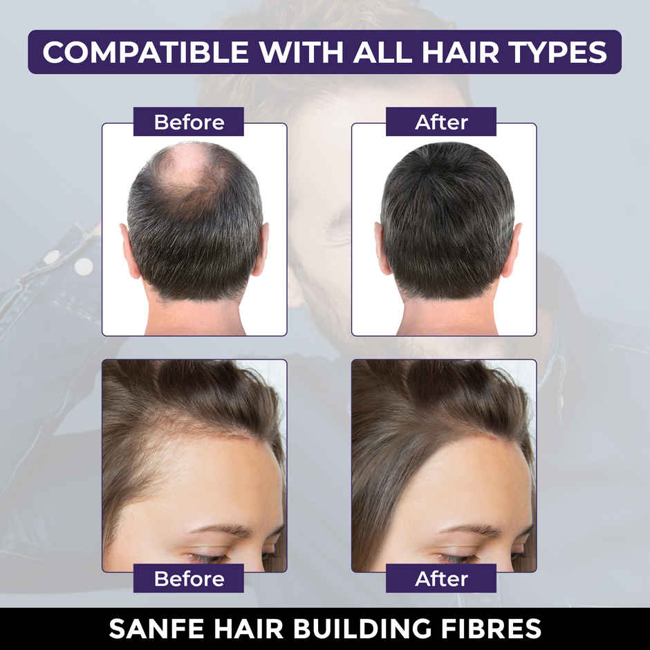 Sanfe Hair Building Fibers | Hair Fiber Powder for Bald Spot & Thinning Hair Cover Up