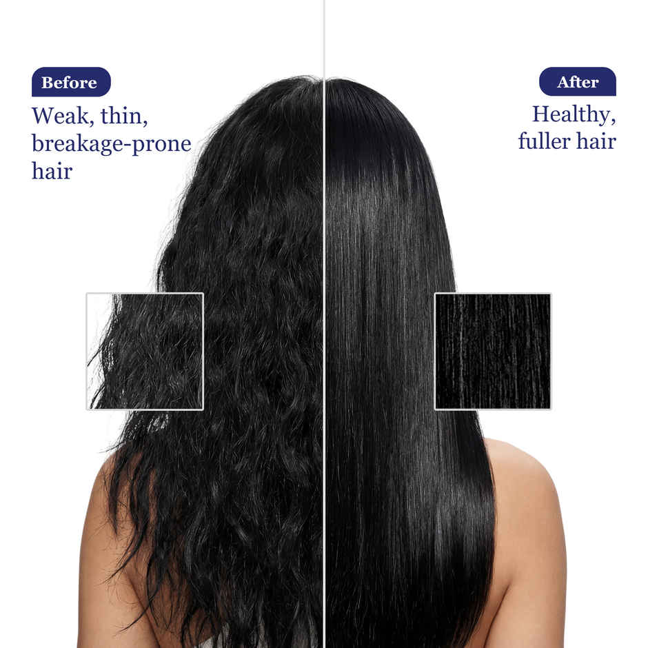 Parachute Advansed Biotin & Coconut Hair Oil | Deep Nourishment for Fuller Hair