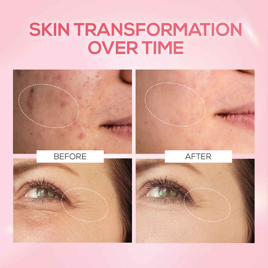 RENEE Pink Therapy PDRN Serum