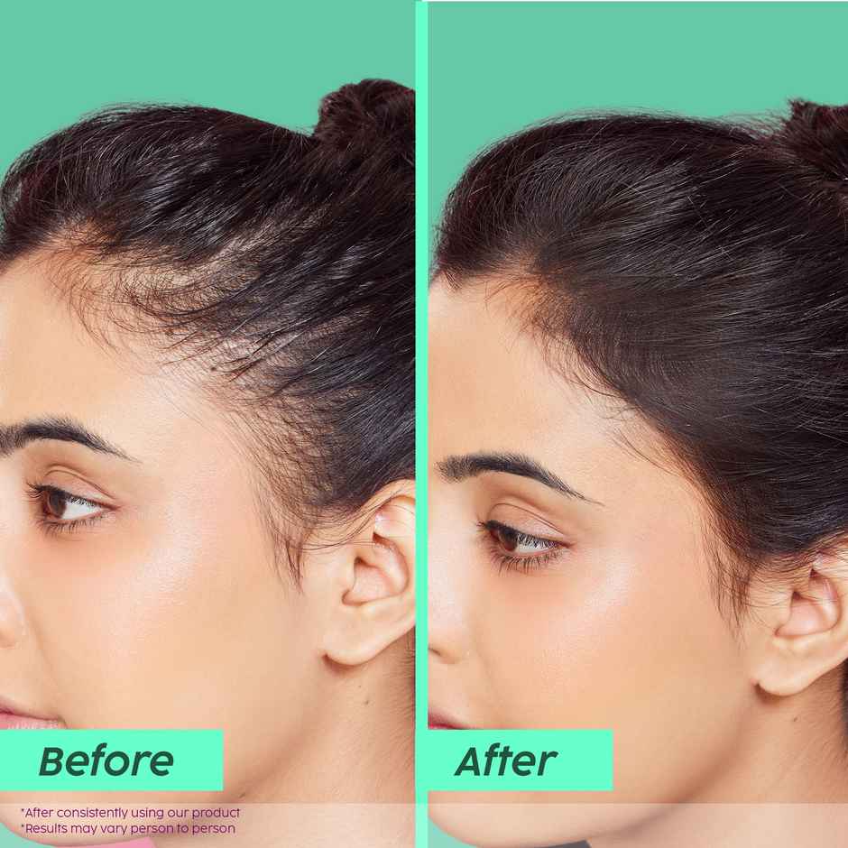 PLIX Rosemary Advanced Anti-Hair Fall Shampoo Sulfate And Paraben Free To Reduce Hair Fall