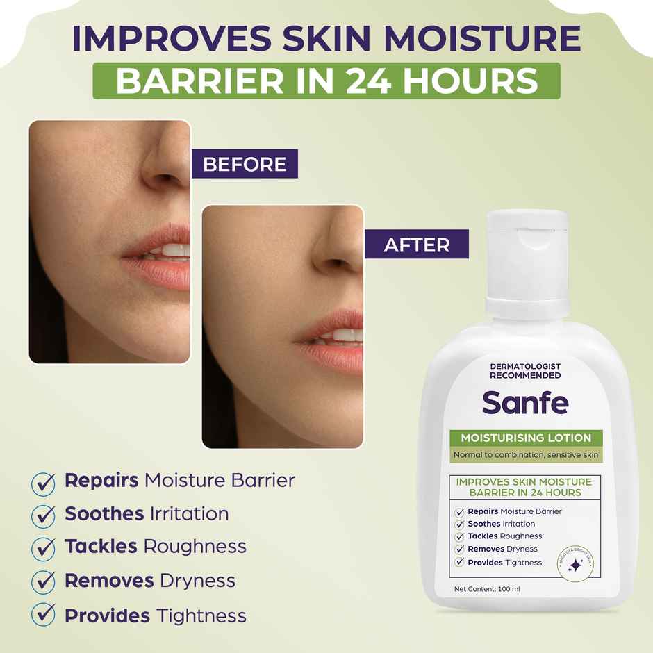Sanfe Moisturising Lotion | Improves Skin Moisture Barrier In 24 Hours | For All Skin Types