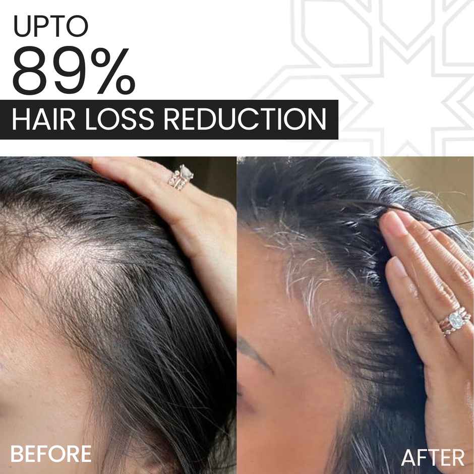 NOVEGROW Intensive Hair Growth Serum | Dermatologically Tested