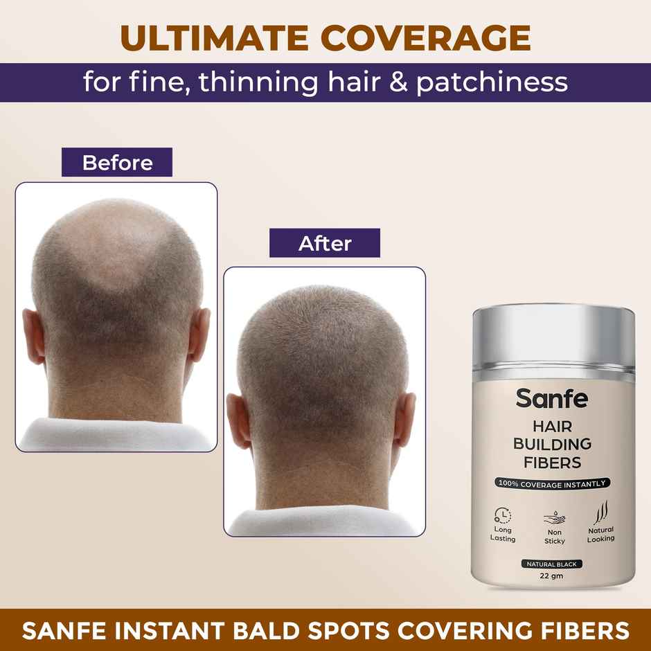 Sanfe Instant Bald Spot Covering Fibers For Instant Thicker & Fuller Look - Black