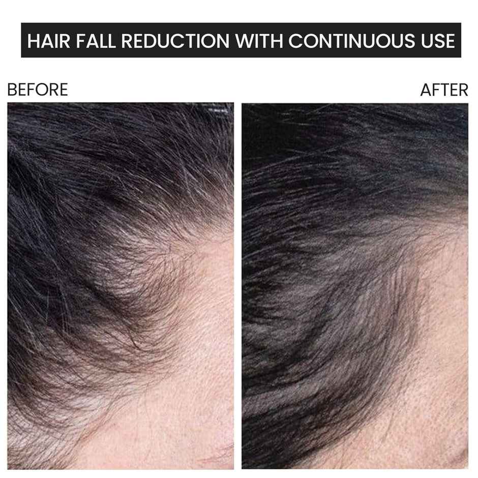 NOVEGROW Anti Hairfall Shampoo With Caffeine and Biotin