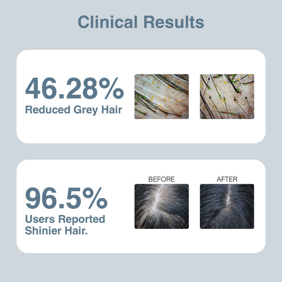 Thriveco Anti-Grey Hair Prime Serum Reverses & Limits Hair Greying Arcolys For Men And Women