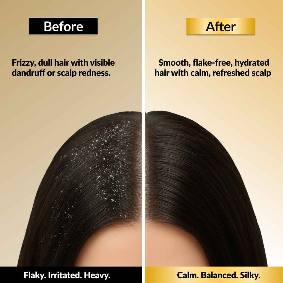 EleGanz Professional ScalpMatrix Anti-Dandruff Conditioner | Climbazole + Dandrilys