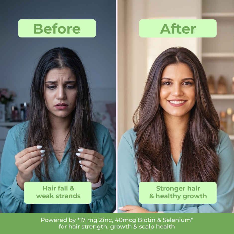 OYB Hair, Skin & Nail Support with Biotin, Zinc & NAC for Hair Growth | 30 Tablets