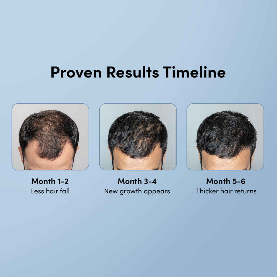 Man Matters Minoxifin Advance Hair Topical Solution