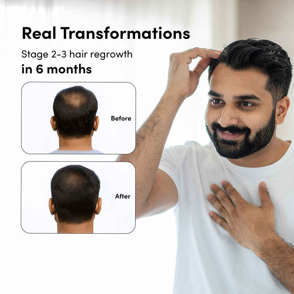 Man Matters Minoxifin Advance Hair Topical Solution