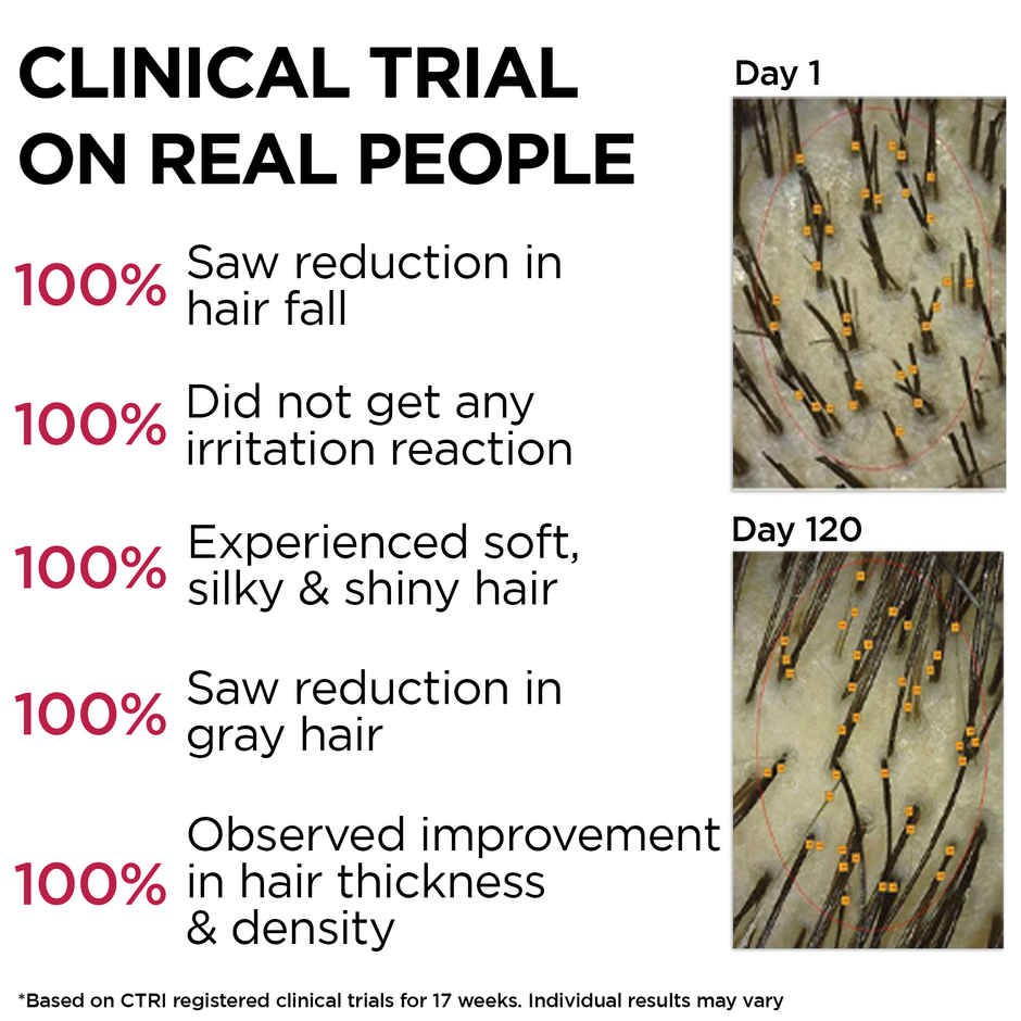 Soulflower Rosemary Redensyl Hair Growth Serum