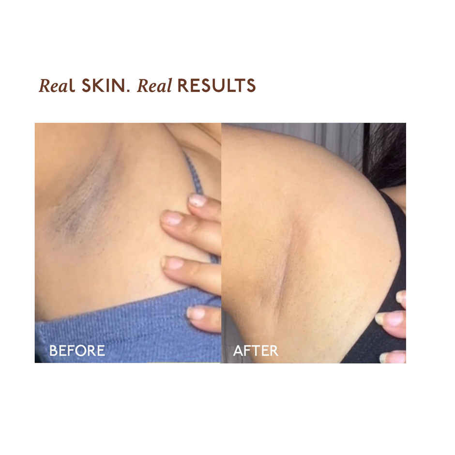 Asaya Even Tone Underarm Mist