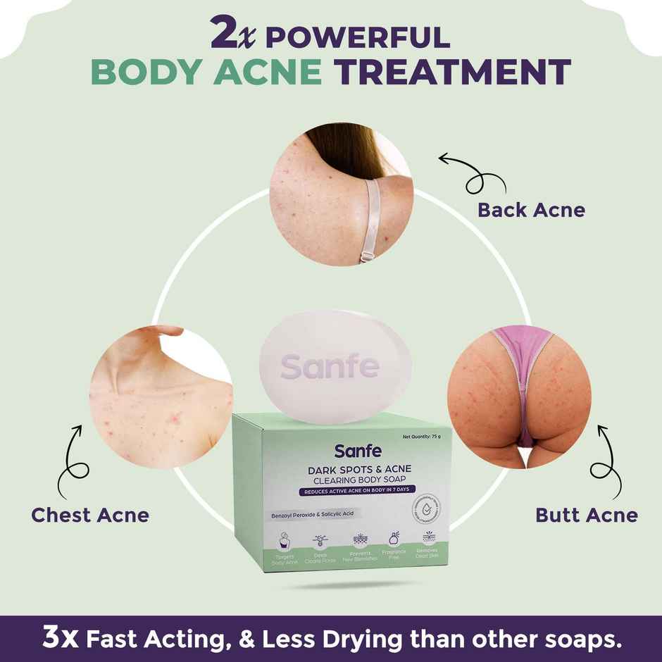 Sanfe Dark Spots & Acne Clearing Soap For Face And Body Pimple Removal Combo    