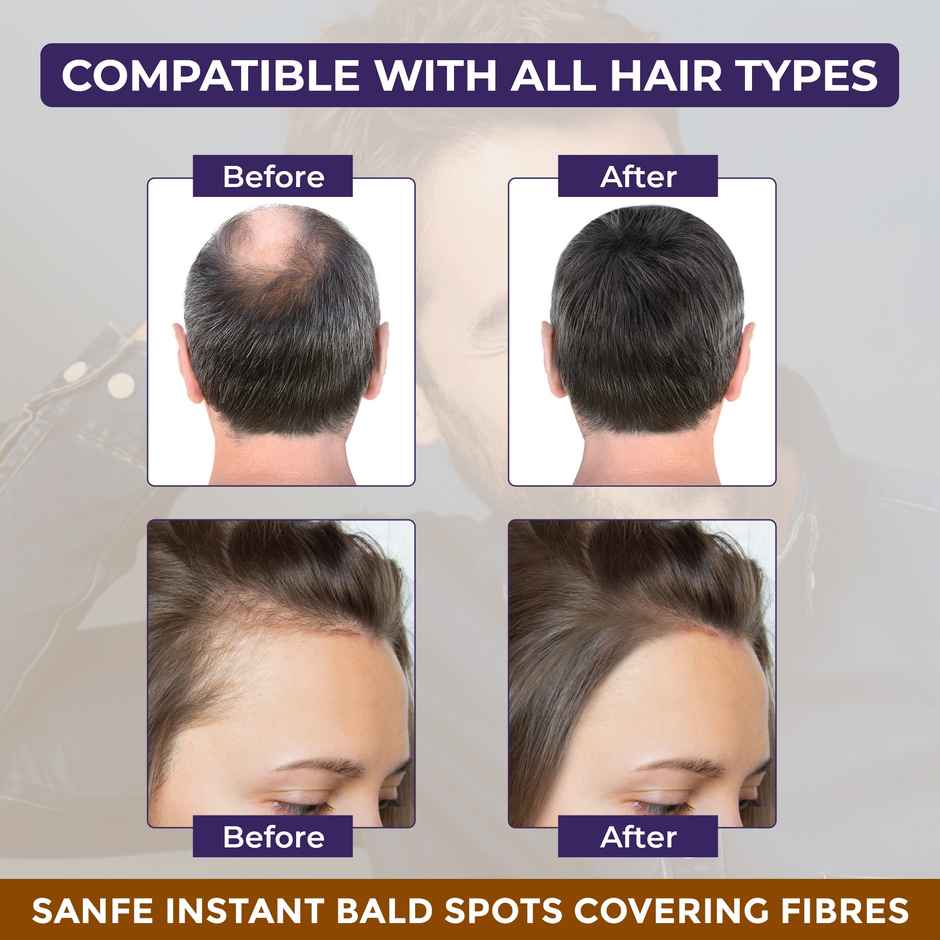 Sanfe Instant Bald Spot Covering Fibers For Instant Thicker & Fuller Look - Black
