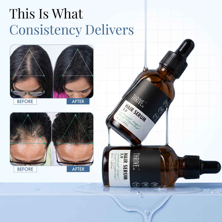 Thriveco Hair Growth Serum 2.0 For Hair Growth & Hair Fall Control