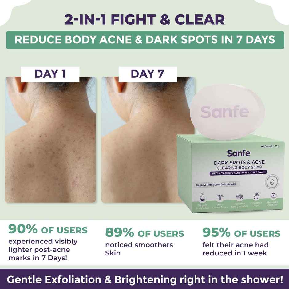 Sanfe Dark Spots & Acne Clearing Soap For Face And Body Pimple Removal