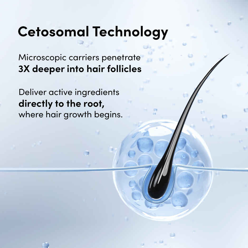 Man Matters Minoxifin Advance Hair Topical Solution