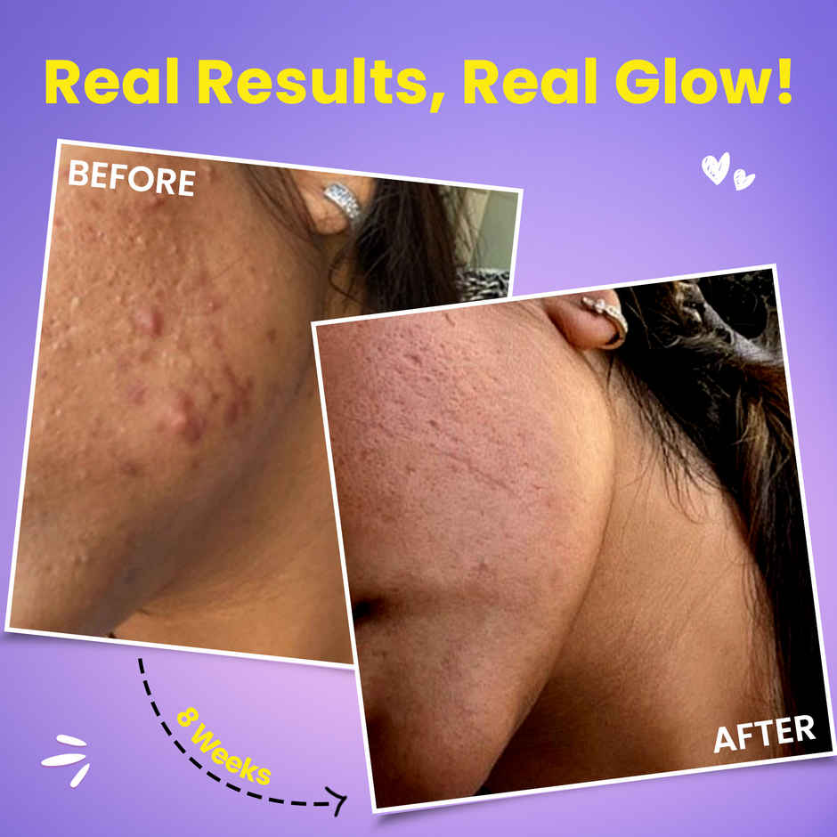 Chicnutrix Glow-Japanese Glutathione & Vit.C Skin Brightening|Strawberry Lemon