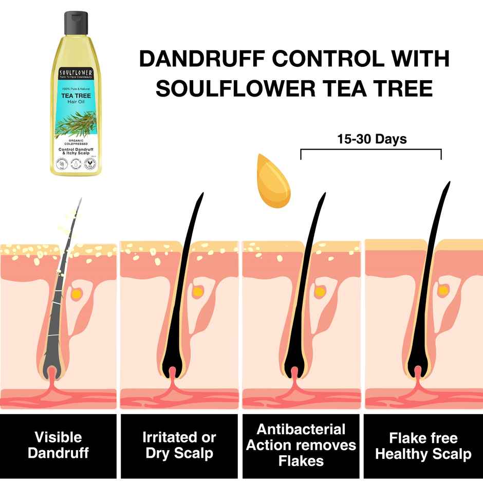 Soulflower Tea Tree Scalp and Anti Dandruff Hair Oil