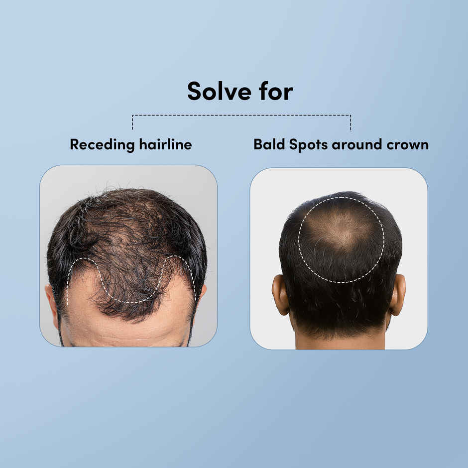 Man Matters Minoxifin Advance Hair Topical Solution