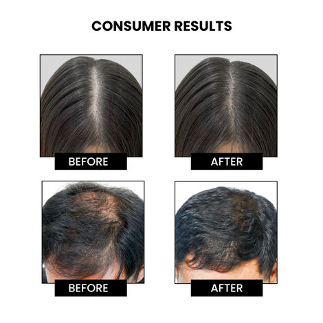 Thriveco Hair Vitalizing Rosemary Shampoo For Hair Fall Control