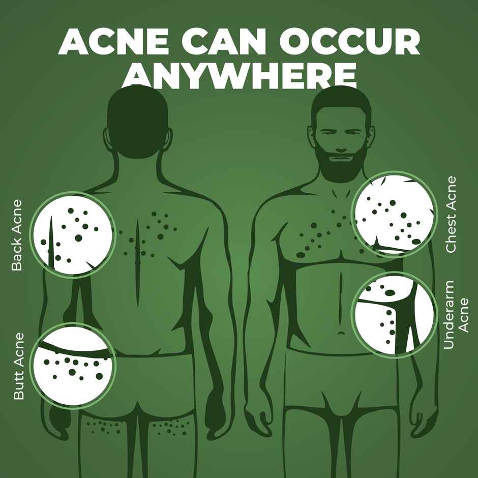 Beardo B-Acne Clear Body Wash Salicylic & Tea Tree