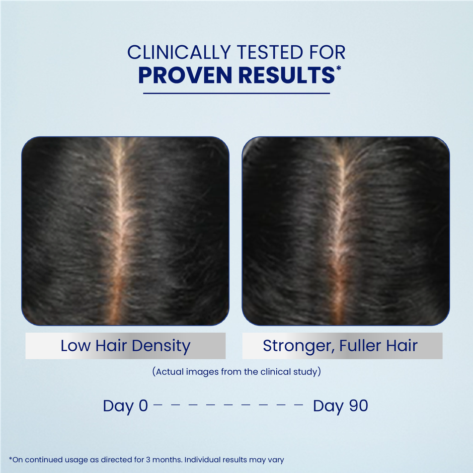 Parachute Advansed Pro Hair Growth Serum | Reduces Hair fall | For Thick & Healthy Hair|Men & Women