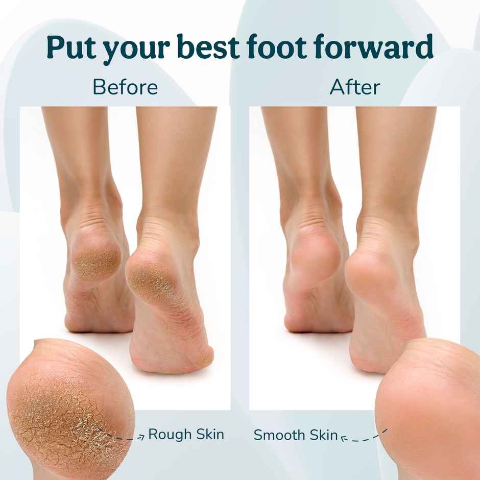 Caresmith Bloom Rechargeable Callus Remover: Effective Foot Scrubber with 3 Roller Heads