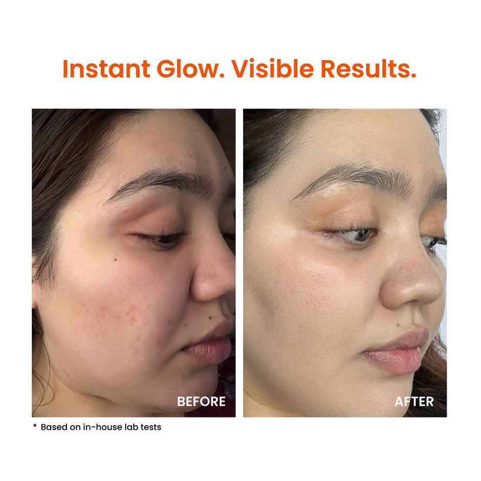 Foxtale Super Glow Moisturizer with Vitamin C